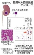 遺伝子働き方で腎臓がん分類