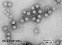 県が初のノロウイルス食中毒警報　発生相次ぎ２月以降早くも５件