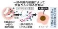 国内大腸がん、５割が細菌原因か