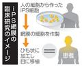 ｉＰＳ網膜の移植、先進医療議論