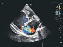 獣医のカルテ１０６<br />犬と猫の心臓病／こもれび動物病院長（富山市中川原）井本博貴