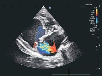 獣医のカルテ１０６<br />犬と猫の心臓病／こもれび動物病院長（富山市中川原）井本博貴