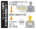ｉＰＳ網膜、先進医療「不適」
