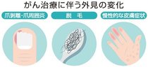 お医者さんに聞いてみよう(48)<br />アピアランスケアとは? 松井恒志さん(富山大付属病院乳腺科・内分泌外科診療科長、総合がんセンターアピアランスケアチーム長)