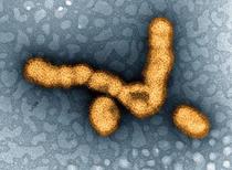 インフル流行、注意報レベルに