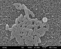 【独自】百日ぜき、薬剤耐性菌が８割