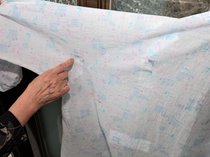 クマの人的被害「命に別条なし」の意味は、富山市民病院形成外科医が解説