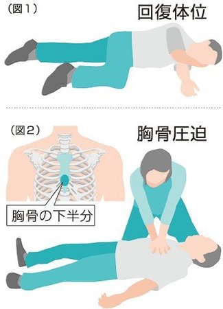 お医者さんに聞いてみよう（４０）<br />救急車が着くまでどうすれば？　土井智章さん（富山大付属病院救急科診療科長）