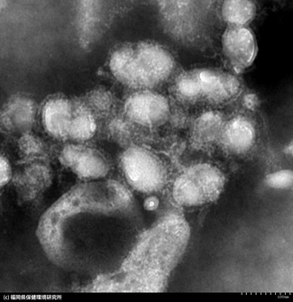 インフル異例の早期流行、コロナと同時感染で症状は?